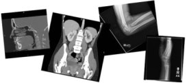 Xray_LockUp
